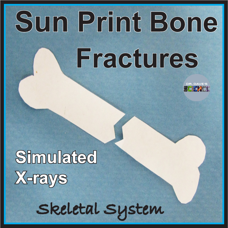 Skeletal System Broken Bone X-Ray Activity Simulation Sun Paper Electromagnetic